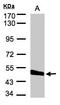 Carboxypeptidase Vitellogenic Like antibody, LS-C185759, Lifespan Biosciences, Western Blot image 