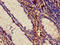 ADAM Metallopeptidase Domain 10 antibody, LS-C375148, Lifespan Biosciences, Immunohistochemistry paraffin image 