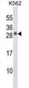 Heparin Binding EGF Like Growth Factor antibody, abx028334, Abbexa, Western Blot image 