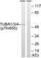 Tubulin Alpha 1a antibody, AP55843PU-N, Origene, Western Blot image 