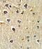 HB2 antibody, GTX81961, GeneTex, Immunohistochemistry paraffin image 