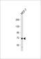 PDZ Domain Containing 1 antibody, 58-038, ProSci, Western Blot image 