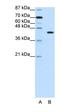 PiggyBac Transposable Element Derived 1 antibody, orb330074, Biorbyt, Western Blot image 