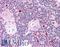 Autoimmune Regulator antibody, LS-B1741, Lifespan Biosciences, Immunohistochemistry paraffin image 