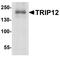 Probable E3 ubiquitin-protein ligase TRIP12 antibody, PA5-38016, Invitrogen Antibodies, Western Blot image 