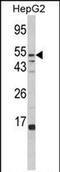 Alpha-L-Fucosidase 1 antibody, PA5-72468, Invitrogen Antibodies, Western Blot image 