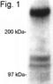 CREB Binding Protein antibody, PA1-847, Invitrogen Antibodies, Western Blot image 