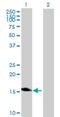 Ring Finger Protein 208 antibody, H00083459-B01P, Novus Biologicals, Western Blot image 