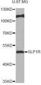 Glucagon-like peptide 1 receptor antibody, LS-C749005, Lifespan Biosciences, Western Blot image 