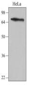 Nuclear Receptor Binding SET Domain Protein 3 antibody, GTX50055, GeneTex, Western Blot image 