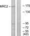 Mannose Receptor C Type 2 antibody, TA314985, Origene, Western Blot image 
