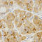 Luteinizing Hormone Beta Polypeptide antibody, LS-C332322, Lifespan Biosciences, Immunohistochemistry paraffin image 