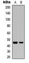 Glycogen Synthase Kinase 3 Beta antibody, LS-C358768, Lifespan Biosciences, Western Blot image 