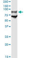 Glycoprotein Ib Platelet Subunit Alpha antibody, LS-C197330, Lifespan Biosciences, Immunoprecipitation image 