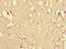 EH Domain Containing 3 antibody, LS-C677784, Lifespan Biosciences, Immunohistochemistry paraffin image 