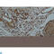 Galectin 3 antibody, LS-C812348, Lifespan Biosciences, Immunohistochemistry paraffin image 