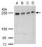 Ankyrin Repeat Domain 26 antibody, GTX128255, GeneTex, Western Blot image 