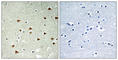 Abhydrolase Domain Containing 14B antibody, abx014137, Abbexa, Western Blot image 