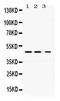 Perilipin 3 antibody, PB10013, Boster Biological Technology, Western Blot image 