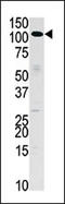 Hexokinase 3 antibody, AP15122PU-N, Origene, Western Blot image 