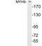 Myosin Heavy Chain 9 antibody, LS-C199927, Lifespan Biosciences, Western Blot image 