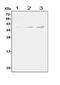 T Cell Receptor Alpha Constant antibody, A05315, Boster Biological Technology, Western Blot image 