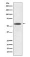 Interferon Regulatory Factor 5 antibody, M00958-1, Boster Biological Technology, Western Blot image 