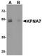 Karyopherin Subunit Alpha 7 antibody, A11830, Boster Biological Technology, Western Blot image 