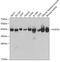 Aldolase, Fructose-Bisphosphate A antibody, GTX30044, GeneTex, Western Blot image 