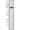 Desmoglein 3 antibody, abx149919, Abbexa, Western Blot image 