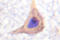 Protein Tyrosine Kinase 2 antibody, LS-C176512, Lifespan Biosciences, Immunohistochemistry paraffin image 