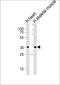 Iodothyronine Deiodinase 2 antibody, MBS9204129, MyBioSource, Western Blot image 