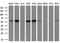 Interferon Induced Protein With Tetratricopeptide Repeats 3 antibody, GTX84314, GeneTex, Western Blot image 
