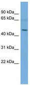 Ankyrin Repeat And SOCS Box Containing 3 antibody, TA344629, Origene, Western Blot image 