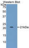 LIF Receptor Subunit Alpha antibody, LS-C295140, Lifespan Biosciences, Western Blot image 