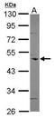 Coronin 1C antibody, PA5-30479, Invitrogen Antibodies, Western Blot image 