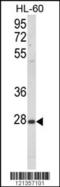 CD48 Molecule antibody, LS-C168546, Lifespan Biosciences, Western Blot image 