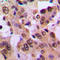 NFKB Inhibitor Beta antibody, GTX32225, GeneTex, Immunohistochemistry paraffin image 