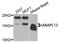 Anaphase Promoting Complex Subunit 13 antibody, STJ112008, St John