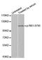 RB Transcriptional Corepressor 1 antibody, MBS128255, MyBioSource, Western Blot image 