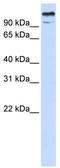 Zinc Finger And BTB Domain Containing 10 antibody, TA331759, Origene, Western Blot image 