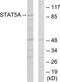 Signal Transducer And Activator Of Transcription 5A antibody, TA313034, Origene, Western Blot image 