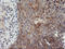 TIMP Metallopeptidase Inhibitor 2 antibody, LS-C173580, Lifespan Biosciences, Immunohistochemistry paraffin image 