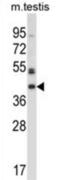 Protein O-Mannose Kinase antibody, abx027948, Abbexa, Western Blot image 