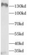 Tau Tubulin Kinase 2 antibody, FNab09076, FineTest, Western Blot image 