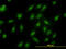 Proteasome Subunit Beta 6 antibody, LS-C133415, Lifespan Biosciences, Immunofluorescence image 