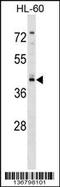 Regulator Of G Protein Signaling 11 antibody, 58-884, ProSci, Western Blot image 