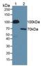 Serpin Family G Member 1 antibody, LS-C293465, Lifespan Biosciences, Western Blot image 