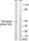 Thyroid Hormone Receptor Beta antibody, PA5-39818, Invitrogen Antibodies, Western Blot image 