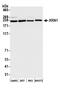 5'-3' Exoribonuclease 1 antibody, A300-443A, Bethyl Labs, Western Blot image 